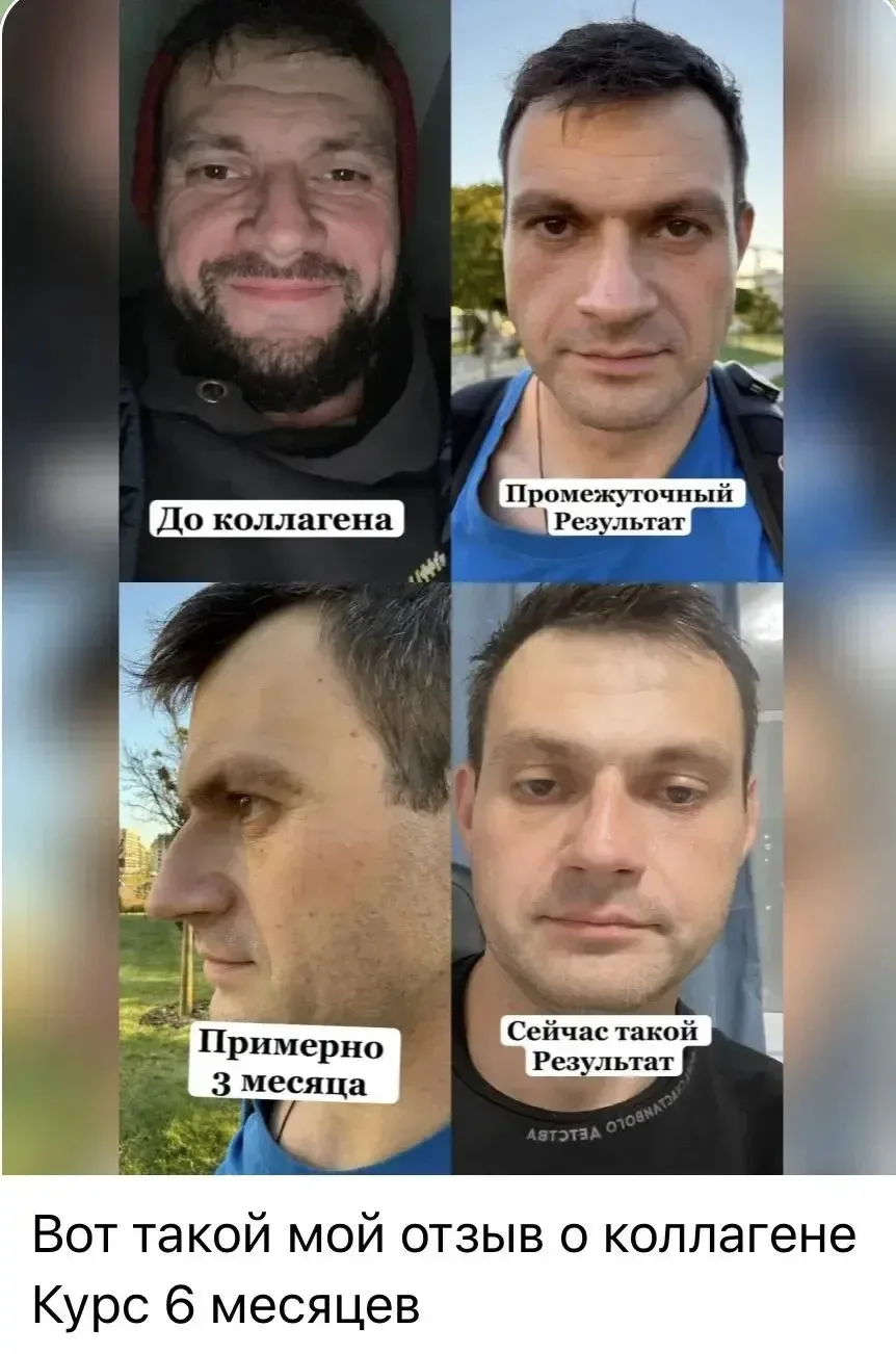 Мужчины тоже любят наш коллаген👌🏼. И вы только посмотрите какой потрясающий результат...
