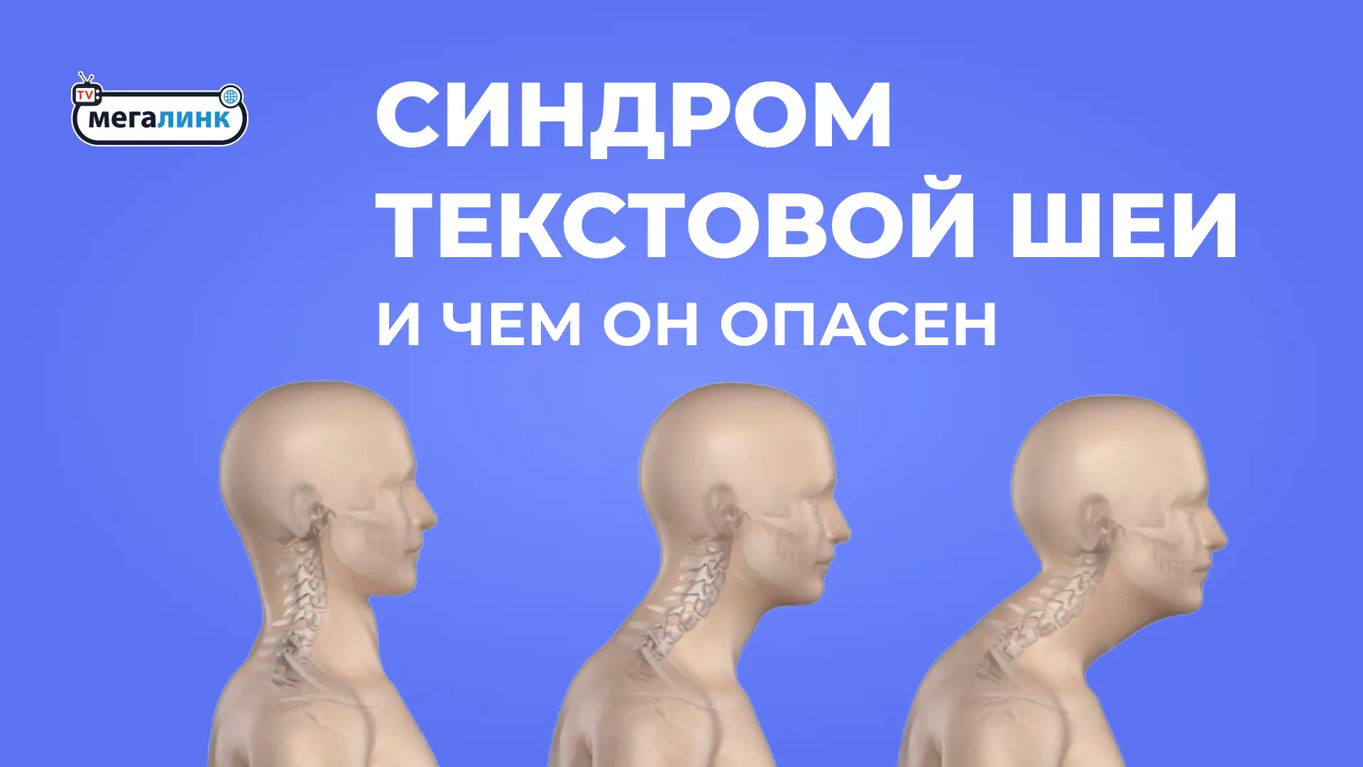 Слышали о синдроме текстовой шеи? 🤔