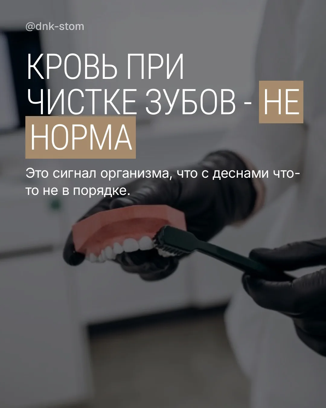 Есть симптомы, которые люди годами не воспринимают всерьез. Кровоточивость десен — один...