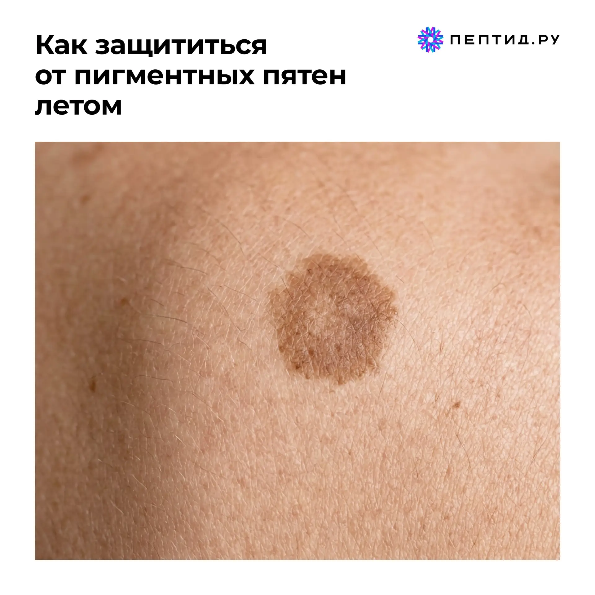 Как защититься от пигментных пятен летом

☀️С наступлением лета УФ-излучение становится главным факт