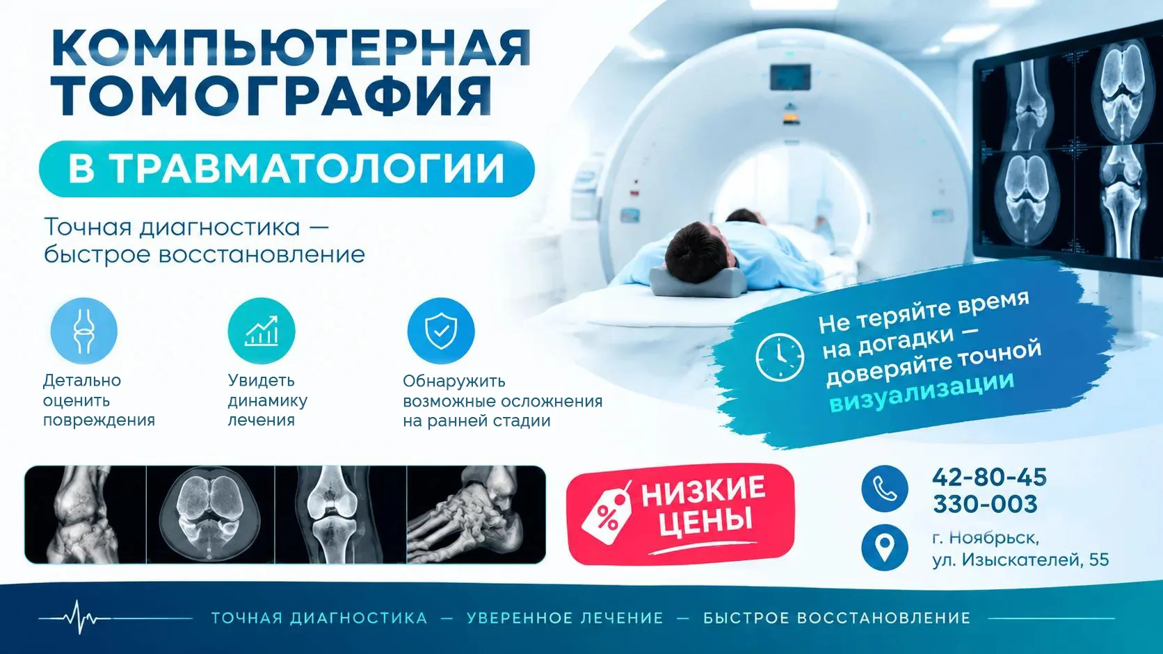 🔸 Компьютерная томография в травматологии – один из ключевых методов диагностики