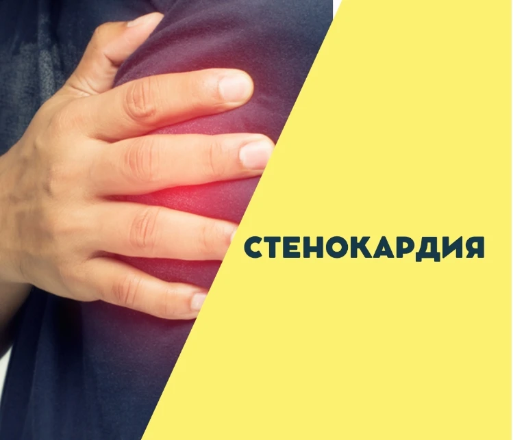 Стенокардия — это не просто «кольнуло в груди». Это как будто на грудь положили тяжёлый...