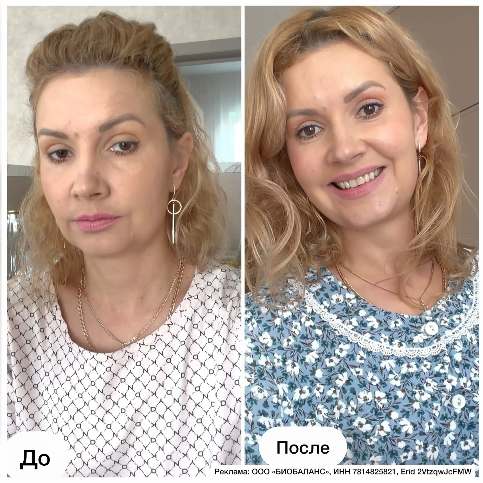Я в восторге от того, что вижу в зеркале! 😍 Лицо стало свежим, ушли все отеки, и я чув...