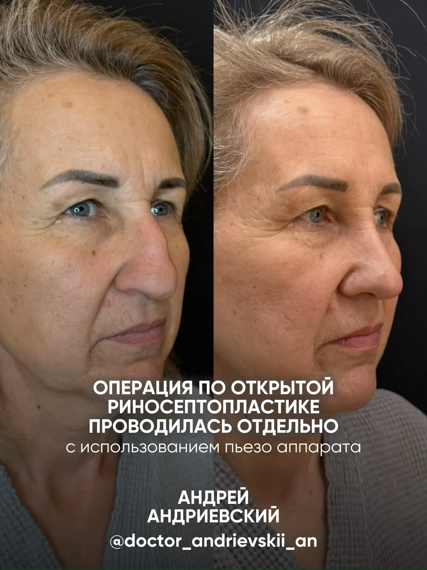 Одиннадцать часов в операционной!