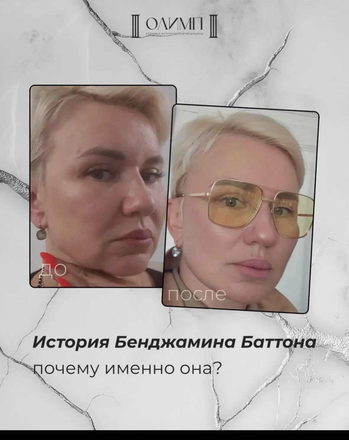 Загадочная история Бенджамина Баттона