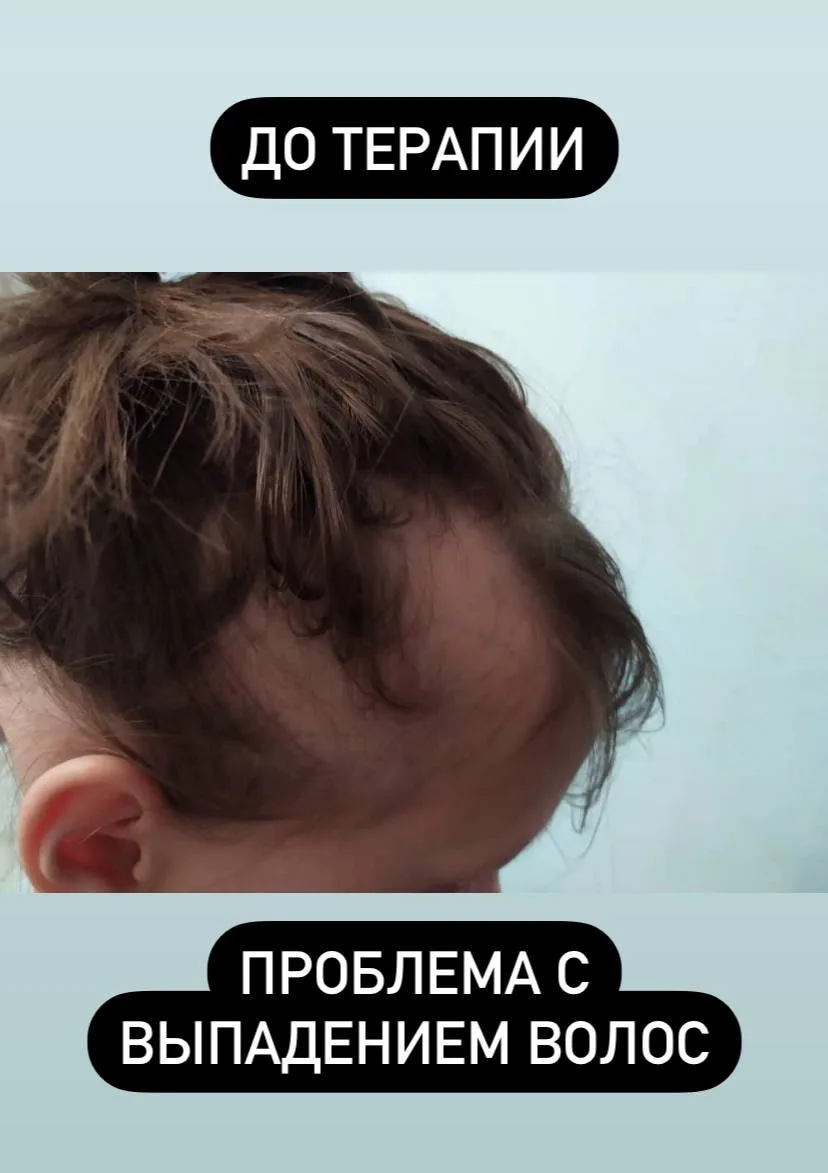 Небольшая подборка обратной связи от наших пациентов, в процессе терапии.