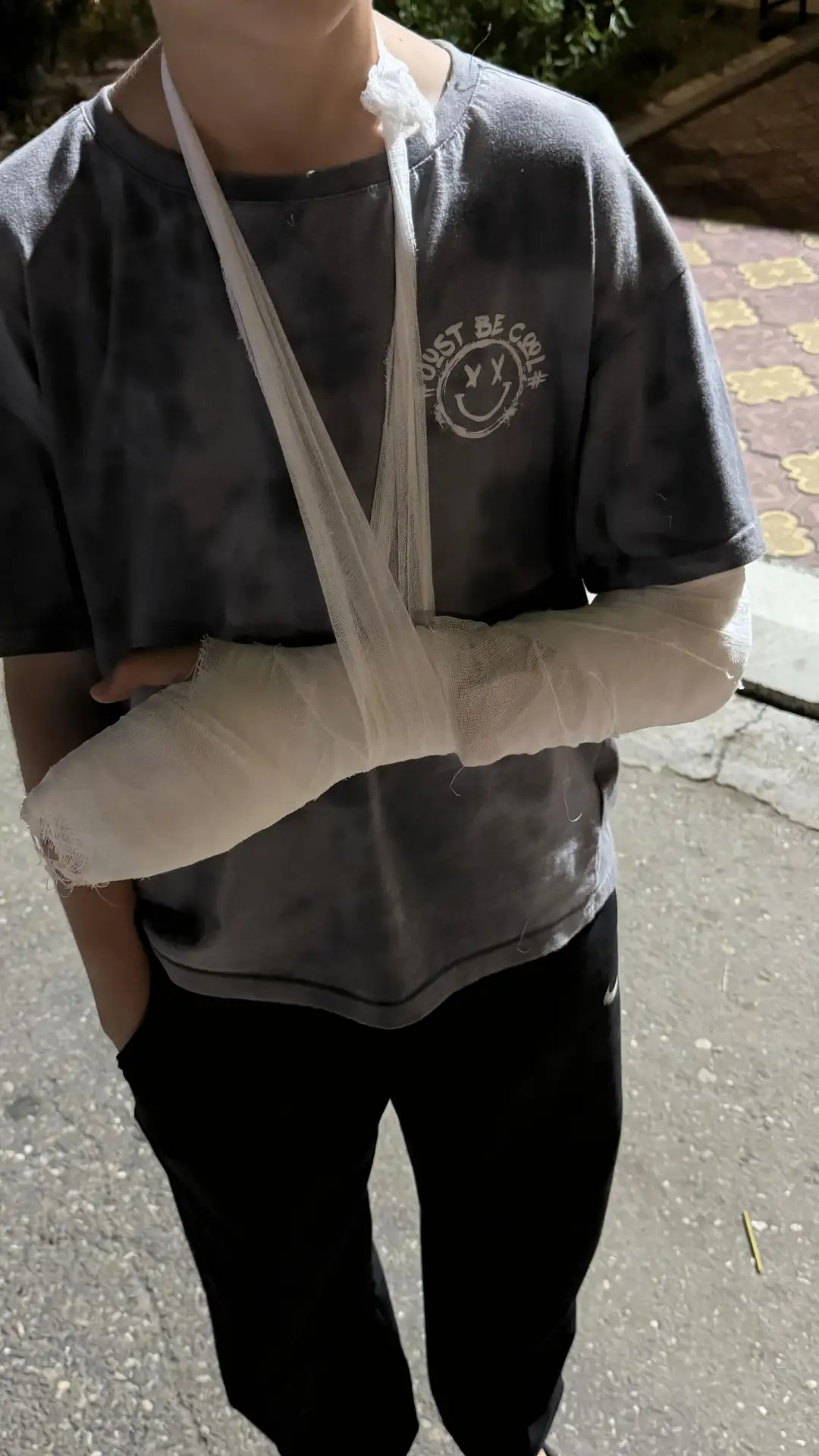В Каспийске на улице Ленина 80, мальчик провалился в люк и получил перелом локтя, а также ушиб ноги.
