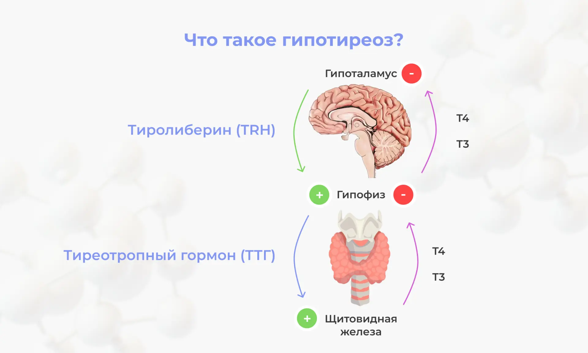 Гипотиреоз