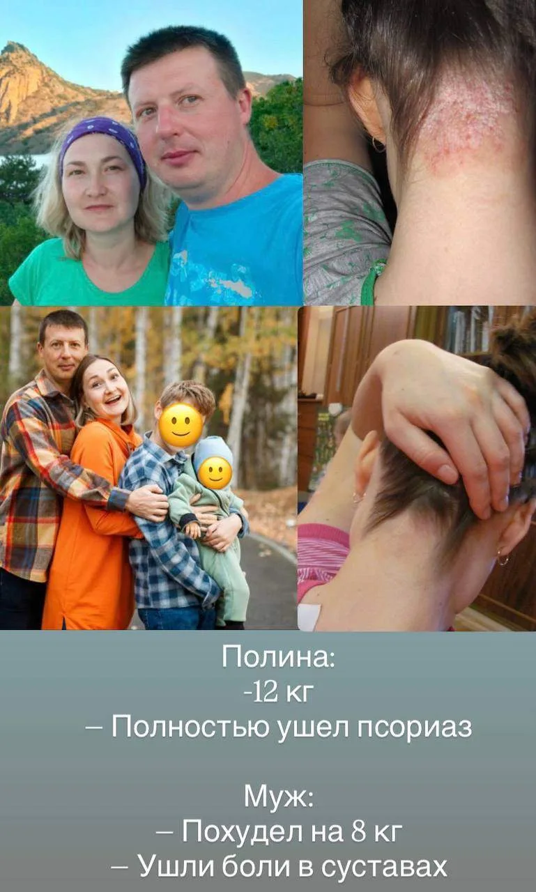 И псориаз, и боли в суставах можно повернуть вспять 
с помощью грамотного выстроенного рациона по на