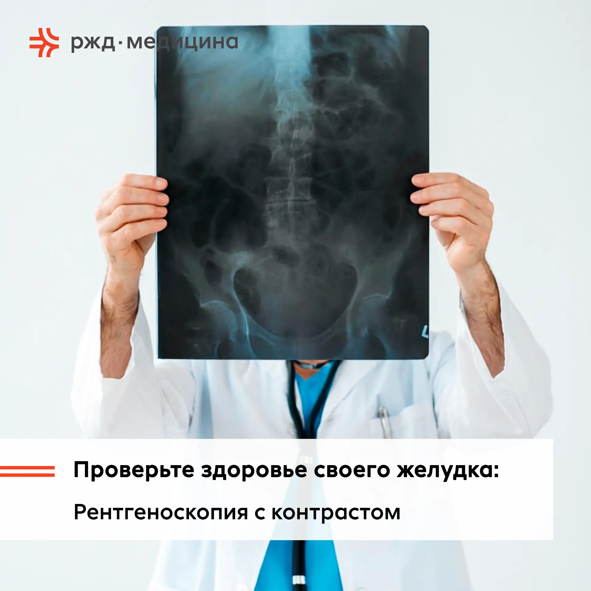 🏥 Рентгеноскопия желудка с контрастом: Подробности о процедуре в “РЖД-Медицина” г. Муром