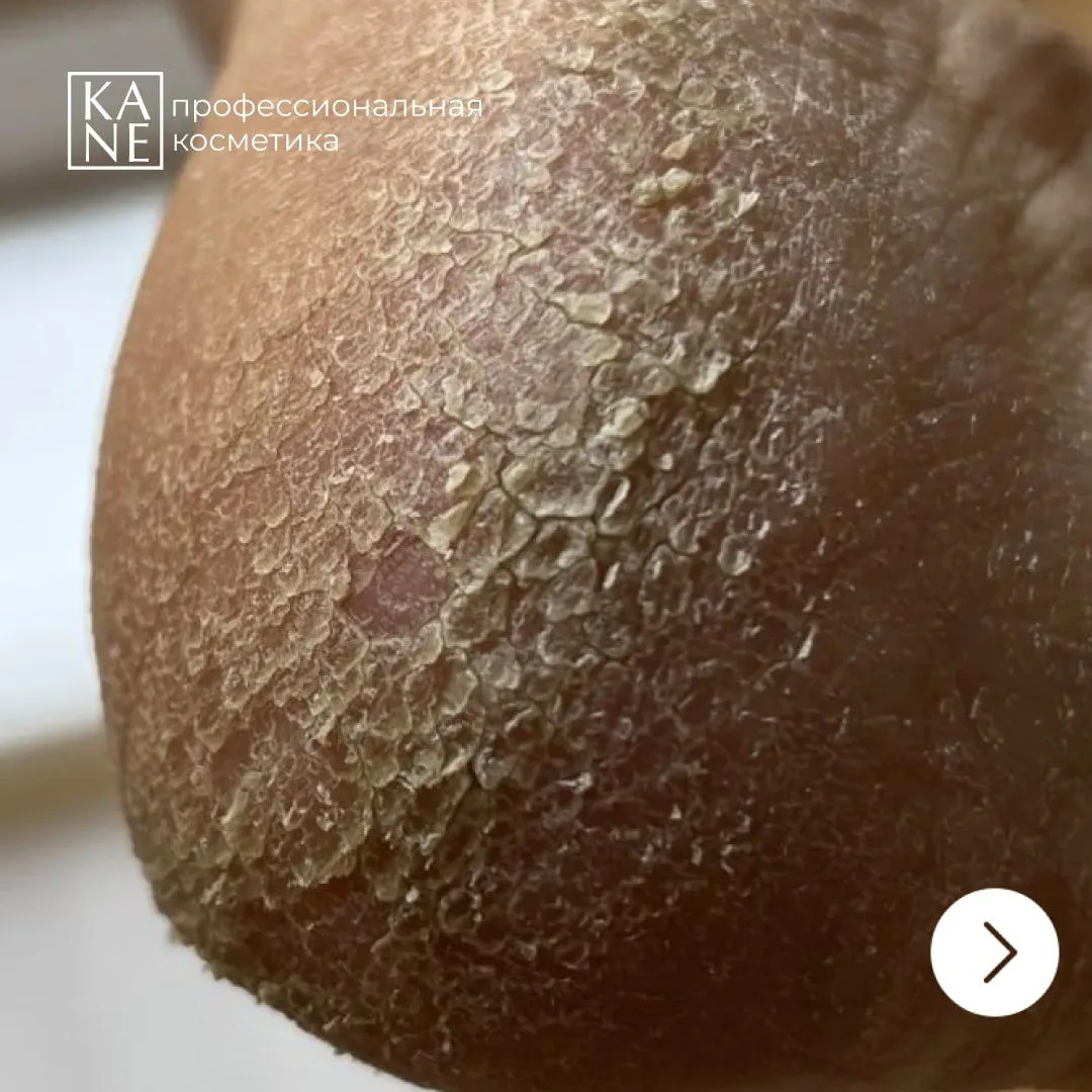 Когда техника действительно работает 😍

Иногда клиент по каким-то причинам не использует домашний у