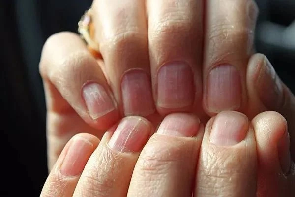 Что делать с ребристыми ногтями?

В первую очередь причиной является недобросовестный маникюр и трав