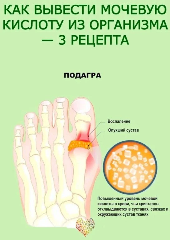ΚАΚ ΒЫΒΕСТИ МОЧΕΒУЮ ΚИСЛОТУ ИЗ ОРГАΗИЗМА — 3 РΕЦΕΠТА...⁉️
