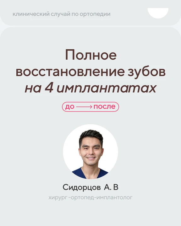 Когда почти не остаётся здоровых зубов – становится трудно полноценно жевать, а улыбка ...