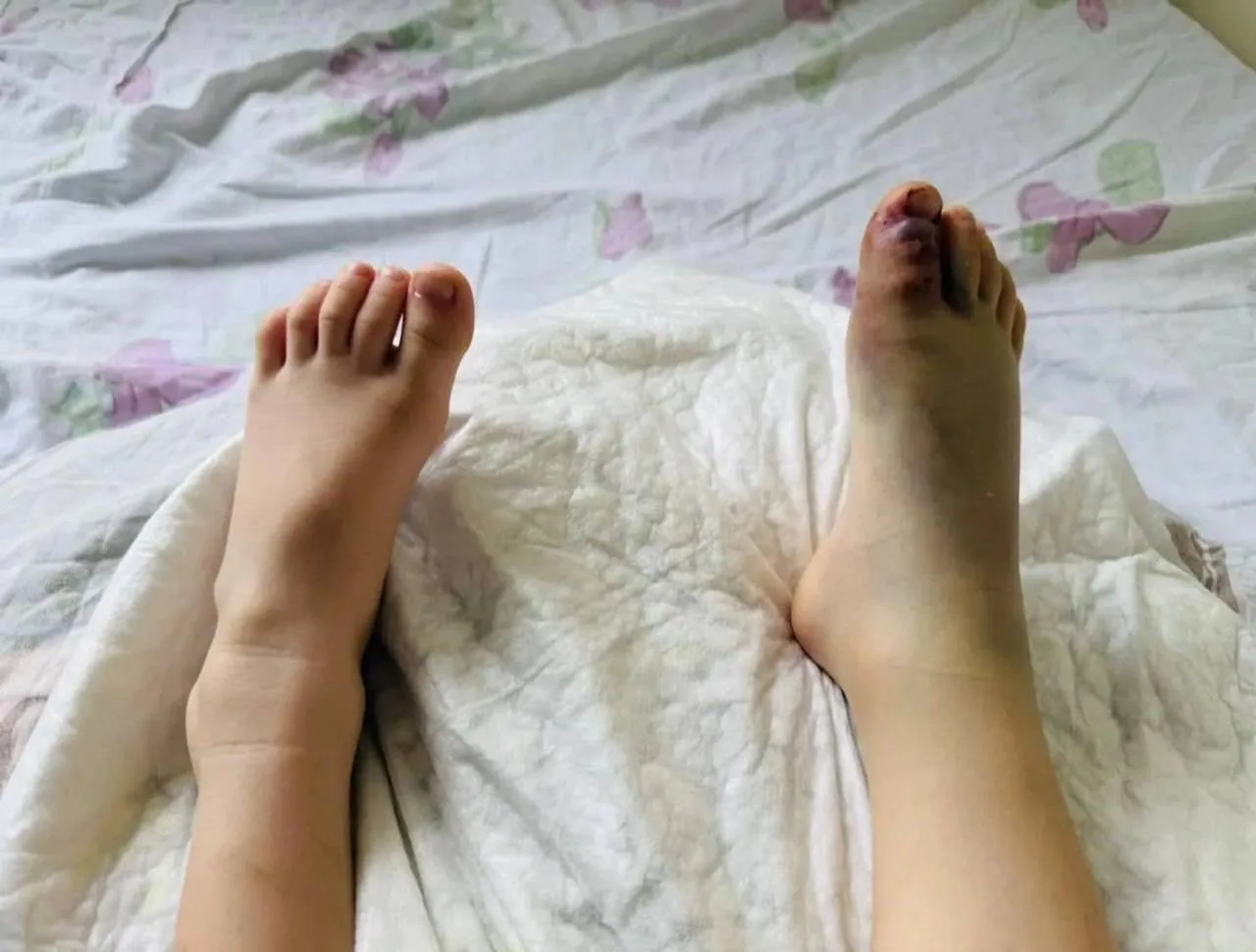 Змея укусила 4-летнего ребёнка на заправке в Приморье