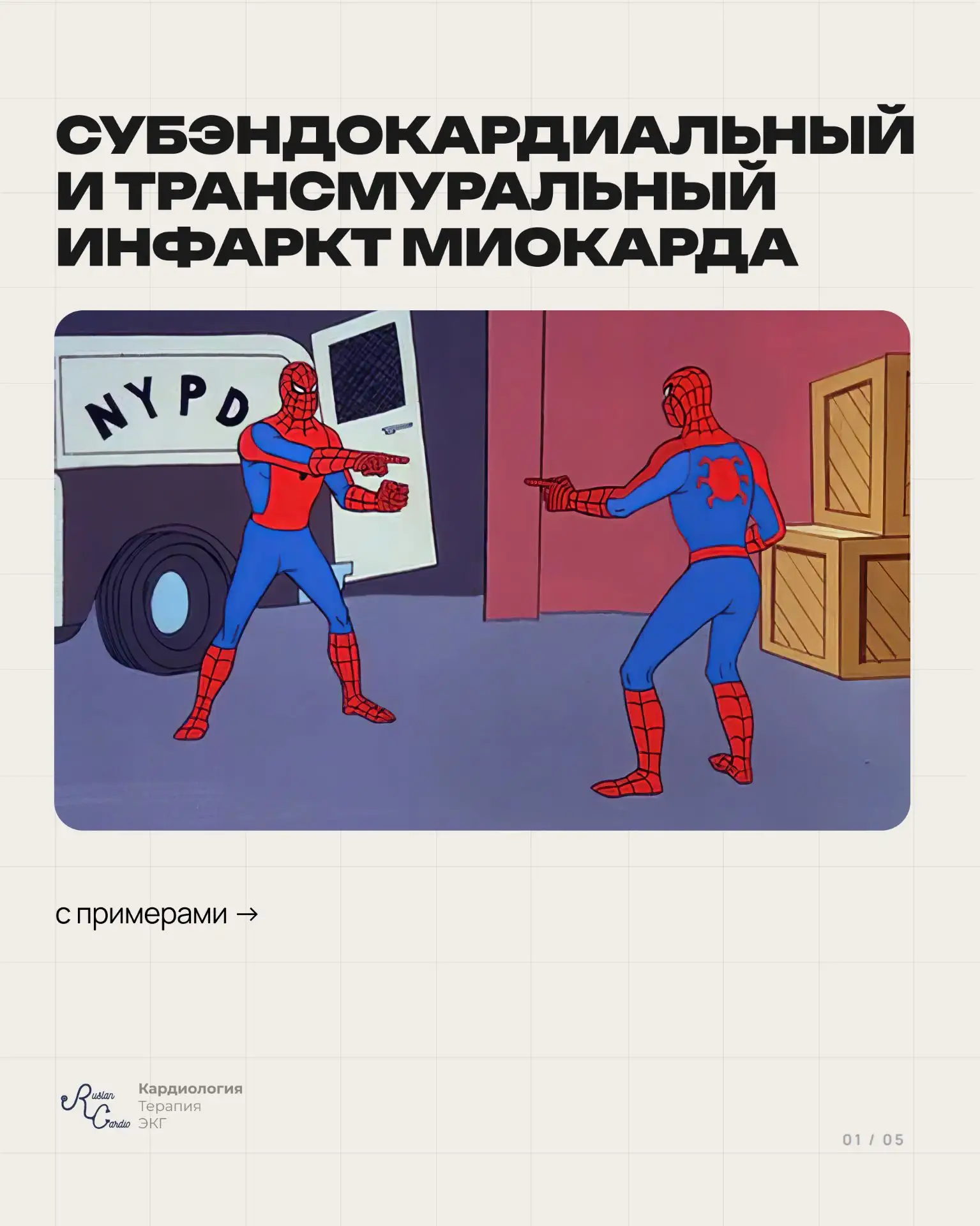 ⚡️ Субэндокардиальный и трансмуральный инфаркт миокарда - в чем разница?

Объяснение + примеры ЭКГ. 