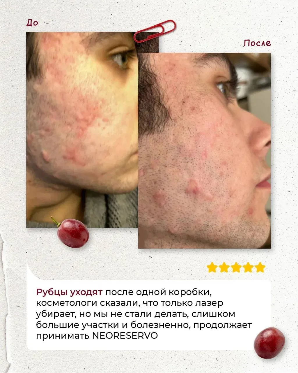 РЕАЛЬНЫЕ ИЗМЕНЕНИЯ С NEORESERVO🍀  Мы собрали ваши отзывы о нашем флагмане🍀, и тут правда есть на что