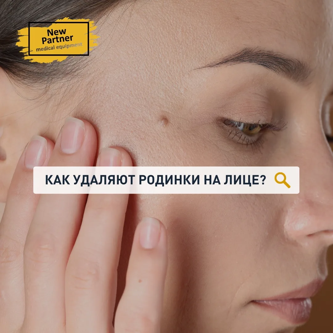Как удаляют родинки на лице? 🤔

Родинки (невусы) — это доброкачественные образования кожи, но в нек