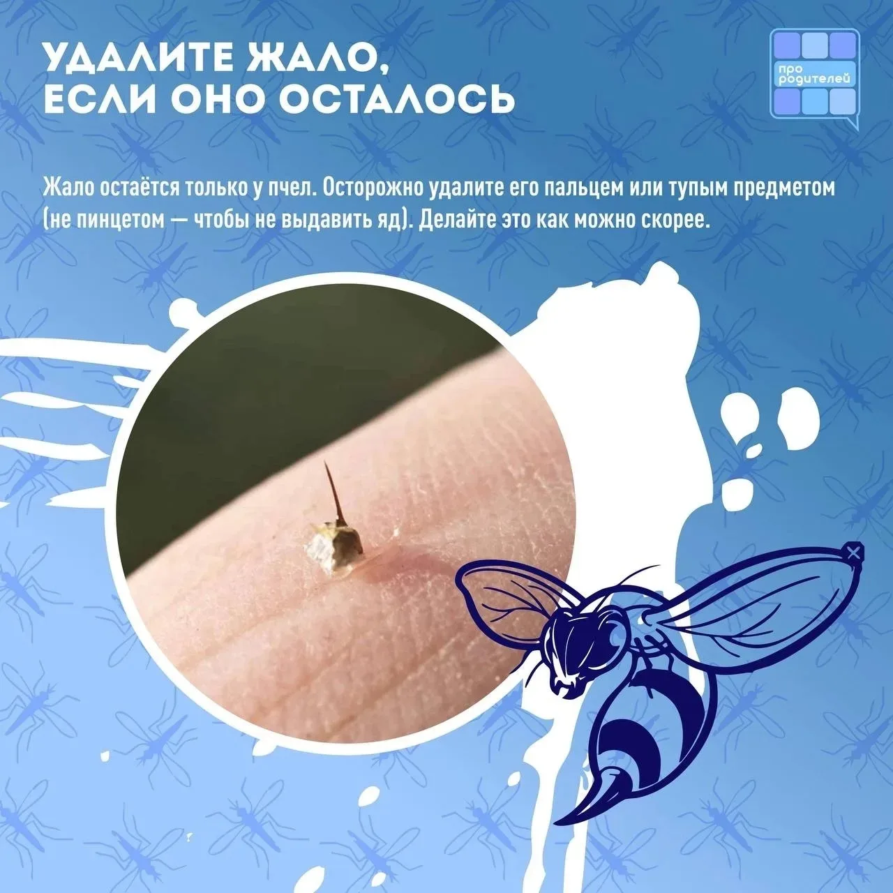 🐝 Укус насекомого: что нужно знать каждому родителю