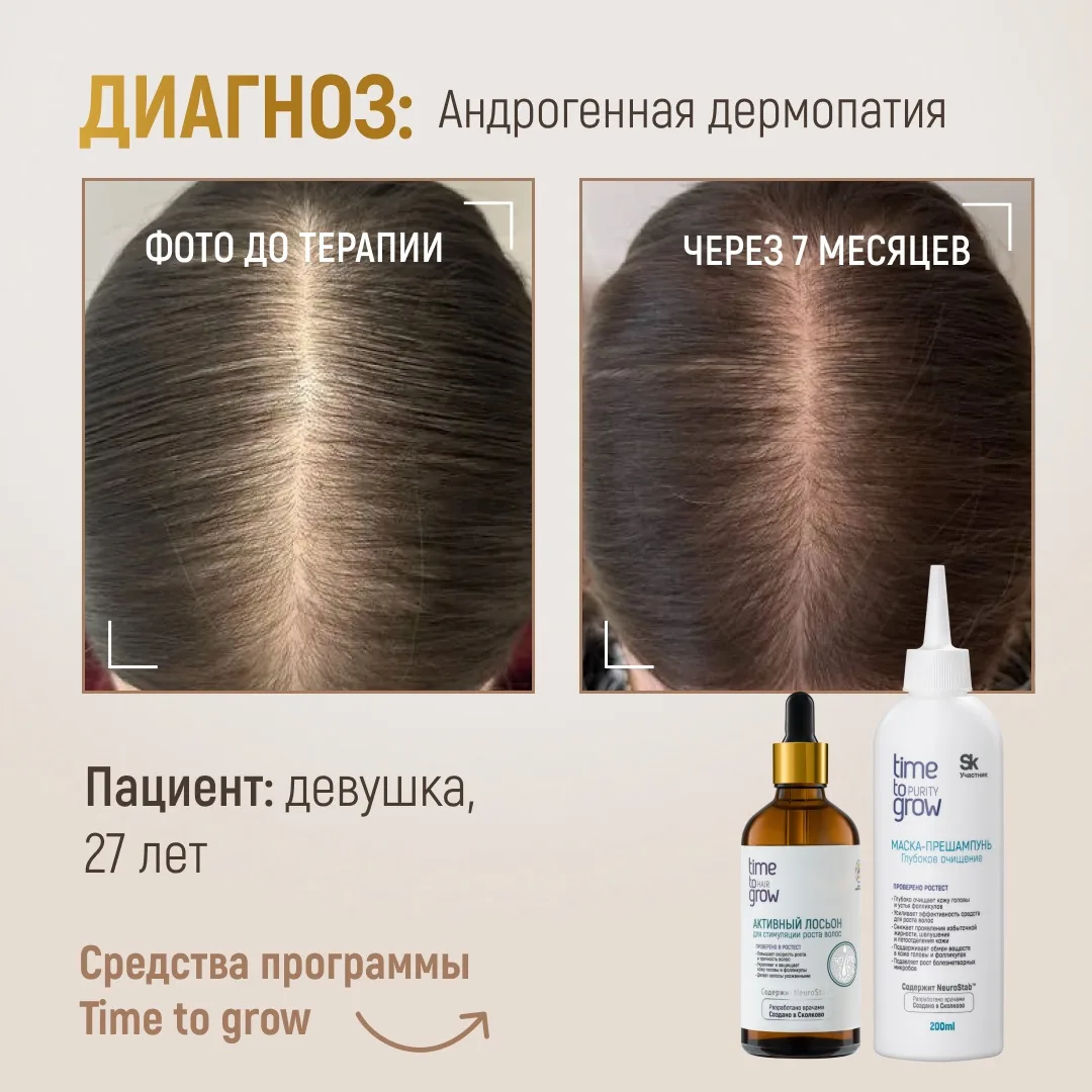 Клинический случай из практики врача-дерматолога, трихолога, трихотрансплантолога, тера...