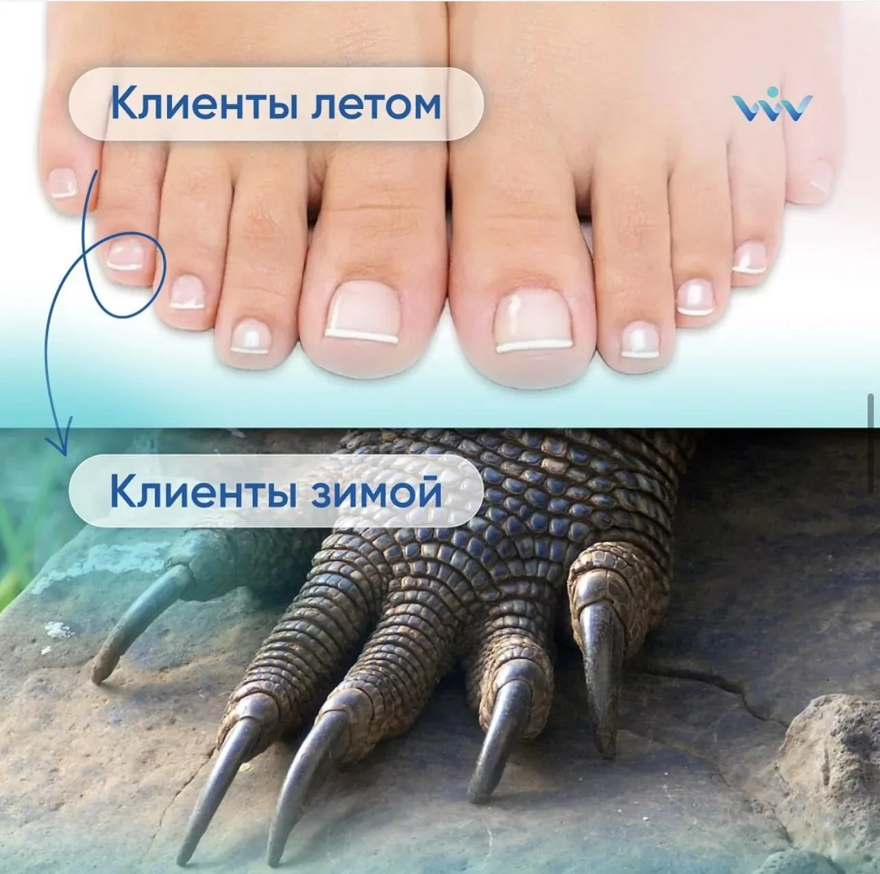 Как правильно стричь ногти на ногах, чтобы они не врастали