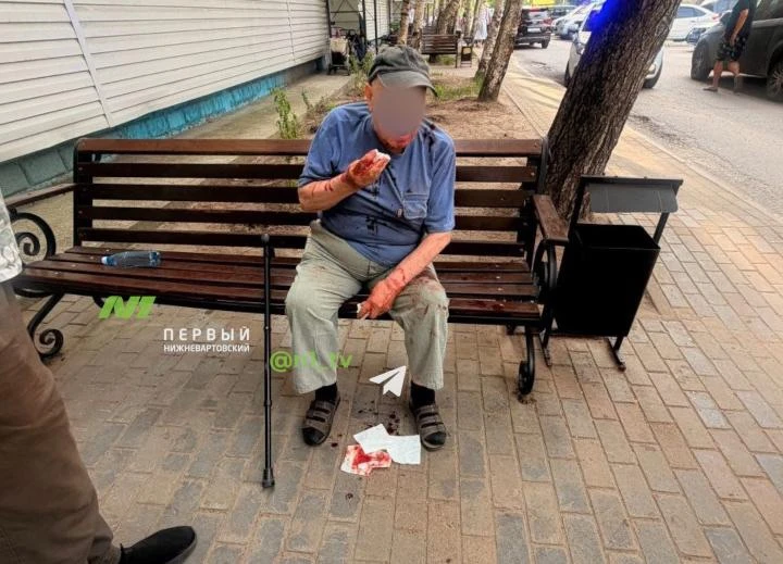 😢 Из-за питбайкеров пострадал дедушка. Эту историю нам рассказал очевидец: