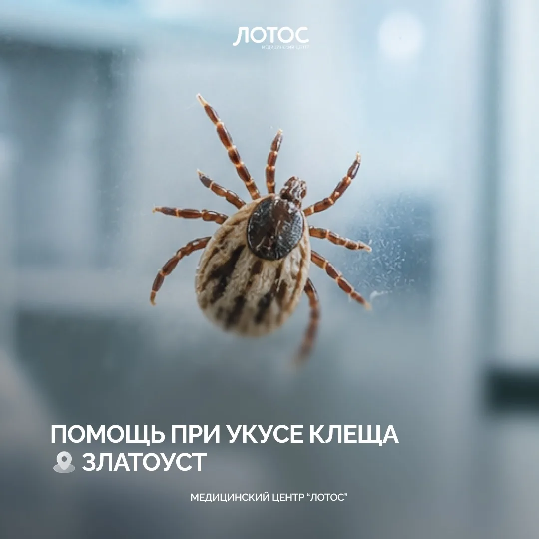 Урал летом — это леса, горы, озёра и походы. И, к сожалению, клещи

Сезон активности клещей в разгар