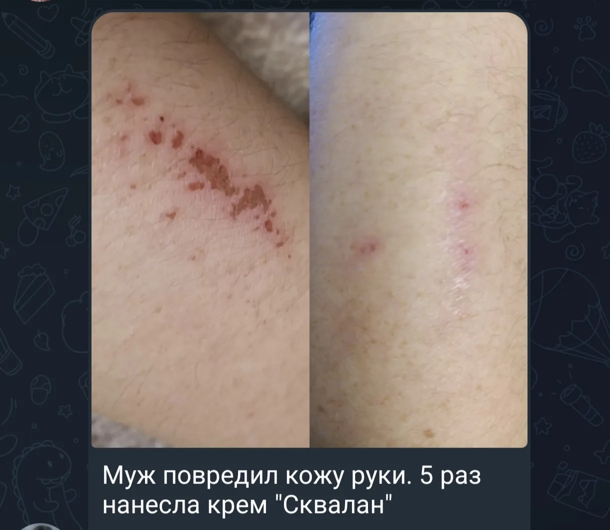 Отзывы девочек ❤️