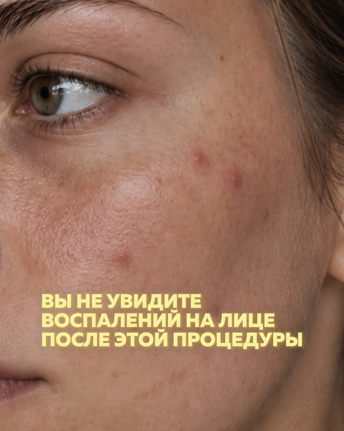 Если вы замечаете частое появление воспалений, что кожа остро реагирует на холод, тепло...