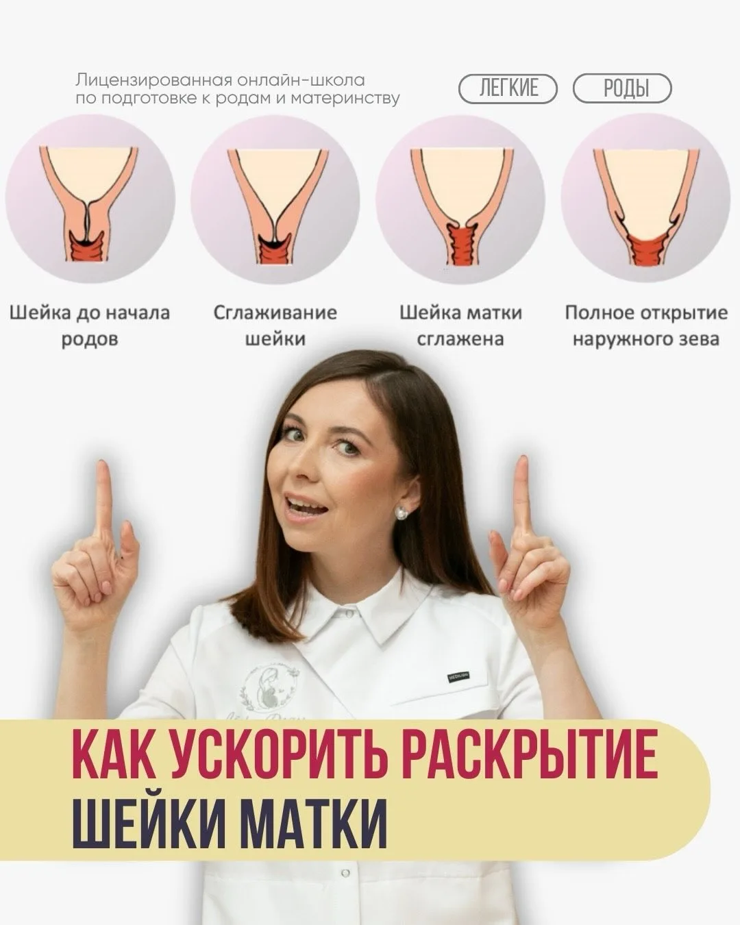 ​​Как ускорить раскрытие шейки матки перед родами? ЧАСТЬ 1️⃣