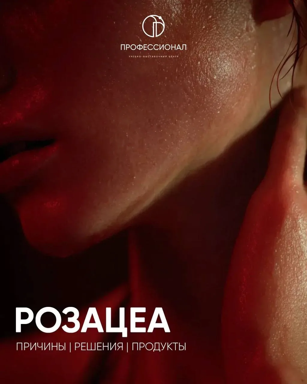 Розацеа — это не «просто покраснение» ✨
