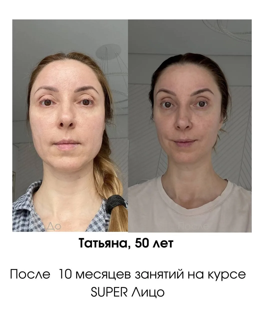 Девочки, хочу поделиться с вами отзывом прекрасной Татьяны, ей 50 лет, просто посмотрите❤️