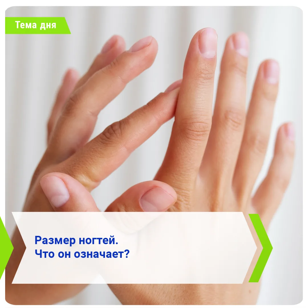 📌 Размер ногтей. Что он означает?

🔹 Долихонихия (удлинённые ногти)

Удлинение ногтей называют «до