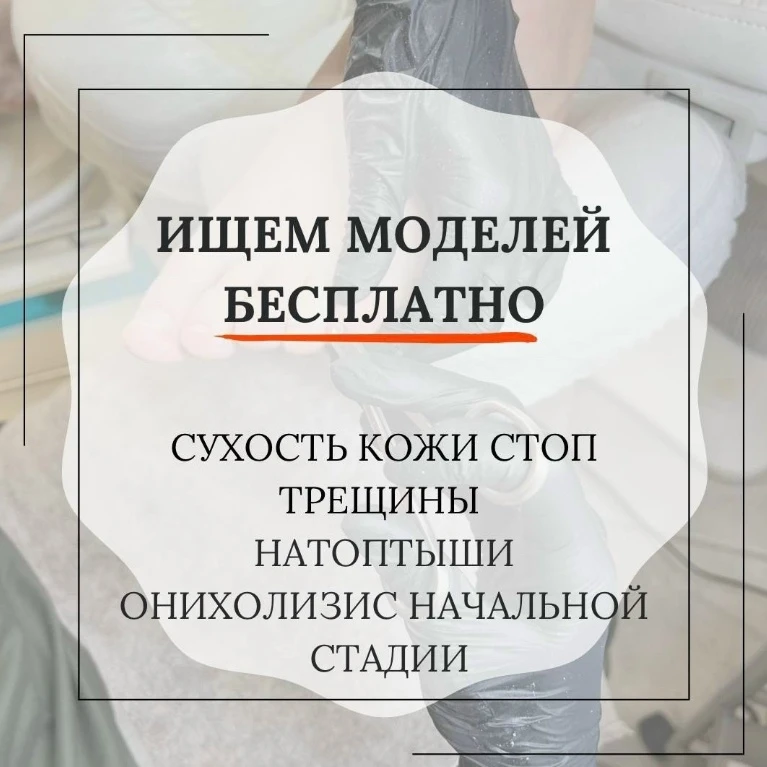 ‼ ИЩЕМ МОДЕЛЕЙ С СУХОЙ КОЖЕЙ СТОП, ТРЕЩИНАМИ И ОНИХОЛИЗИСОМ НАЧАЛЬНОЙ СТАДИИ на БЕСПЛАТНУЮ подологич