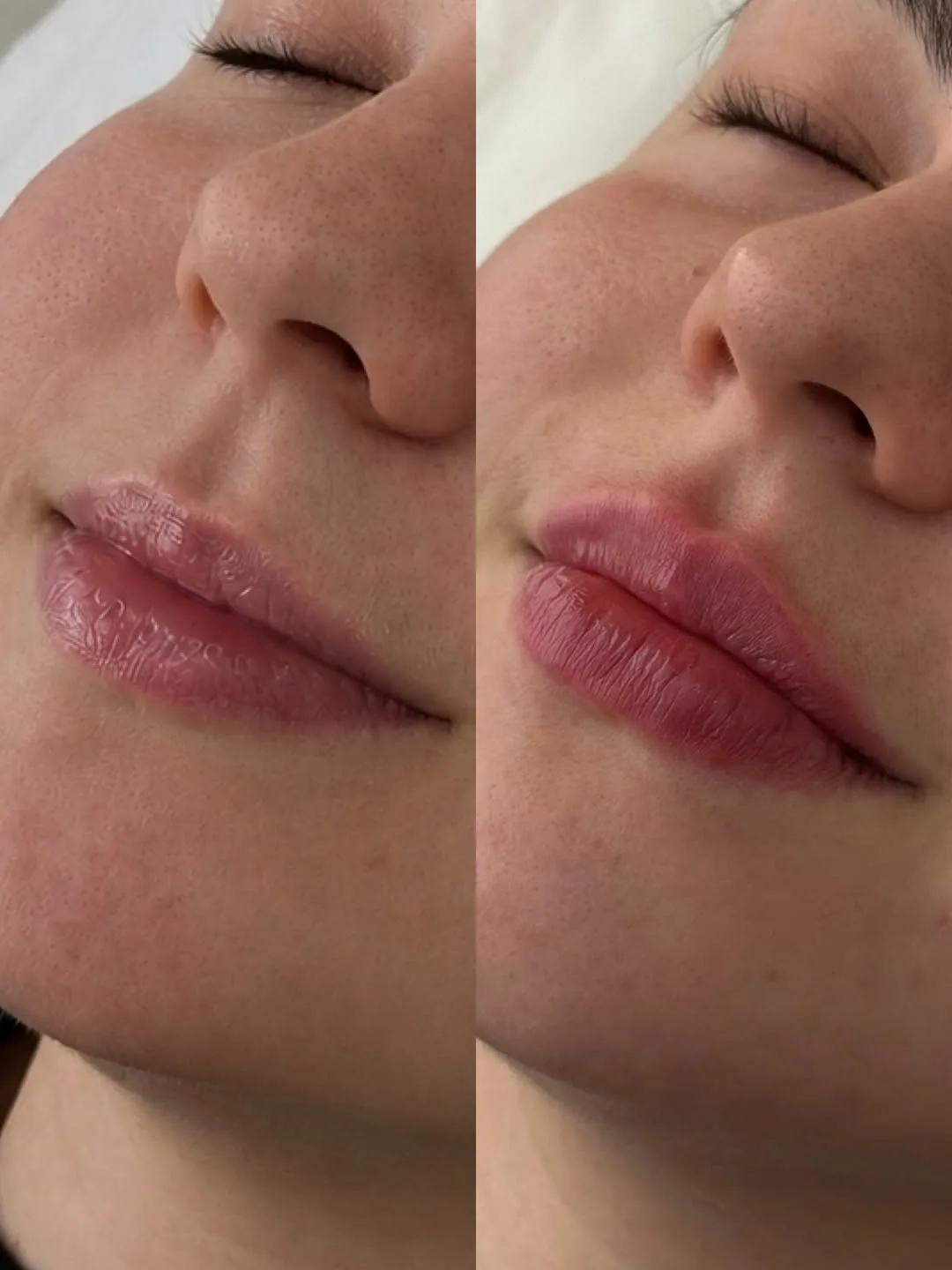 СОЧНЫЕ И НАТУРАЛЬНЫЕ ГУБЫ 💋

Красивые губы способны преобразить всё лицо: сделать черты более гармо