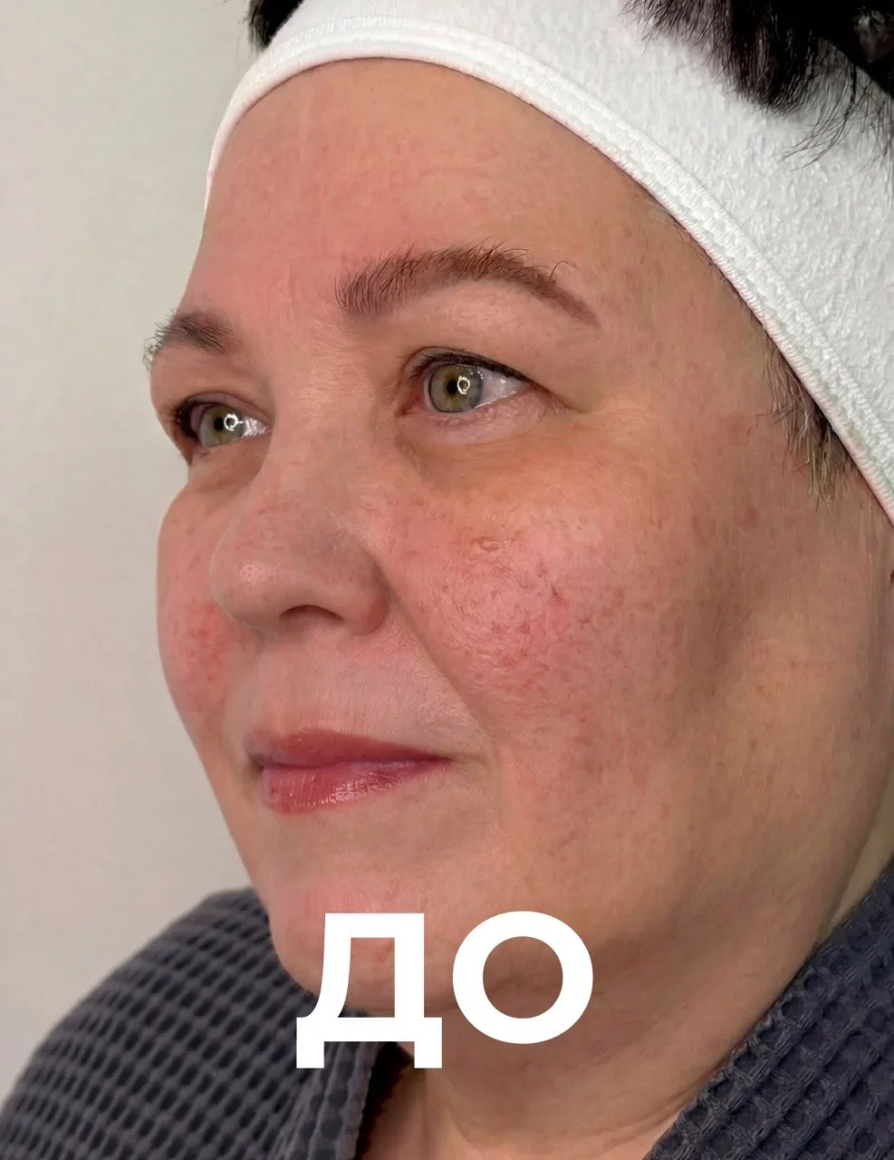 Скажите «нет» покраснениям и раздражению!