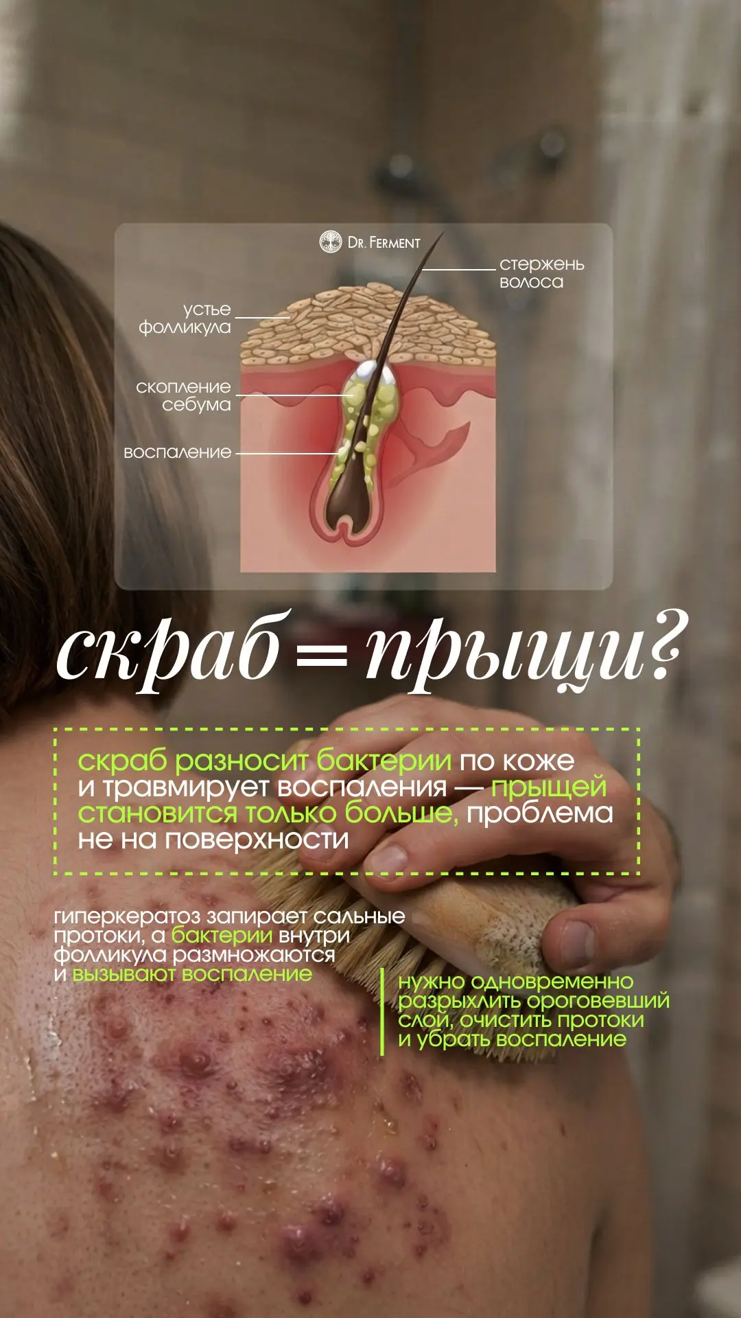 гусиная кожа, вросшие волосы и прыщи,  появляются не от недостатка скрабов. Причина глубже: ороговев