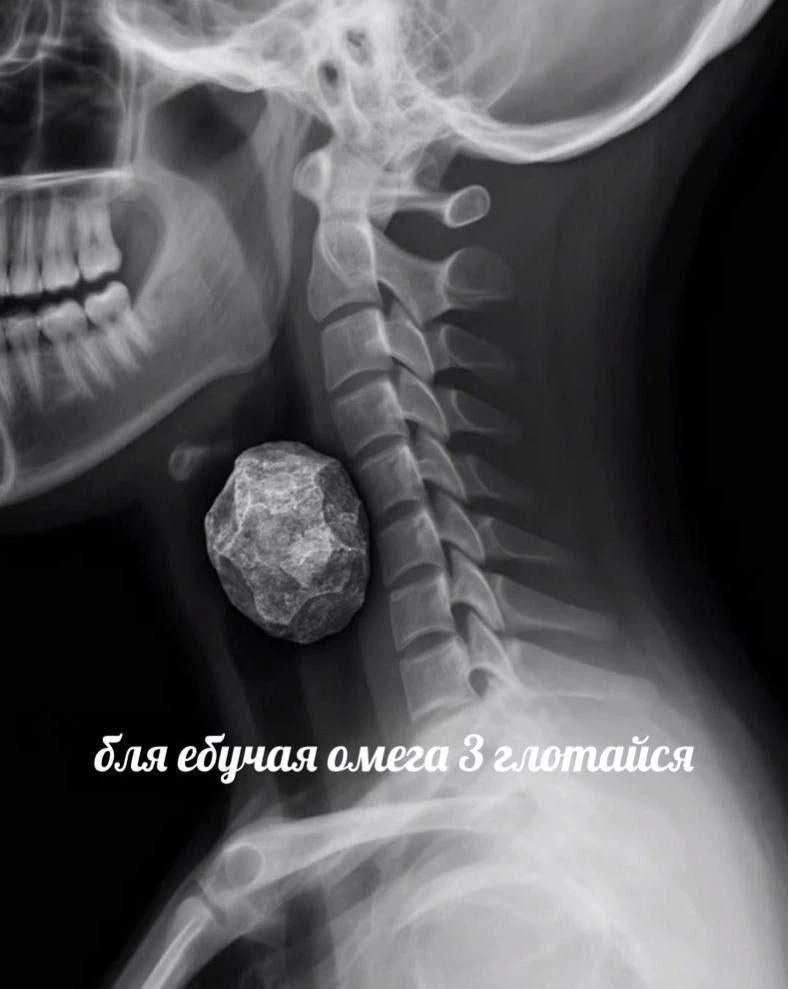 Страх №374 - умереть от зожа   Ладно, шучу, полный зож мне пока не грозит 😁
