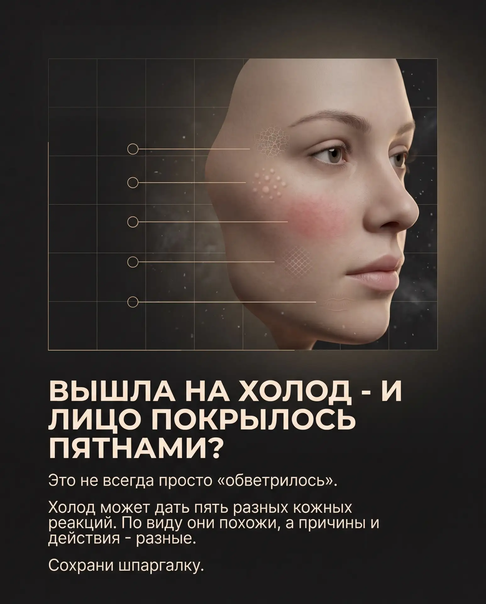 Вышла на холод - и лицо покрылось пятнами? Не спеши списывать всё на «обветрилось».