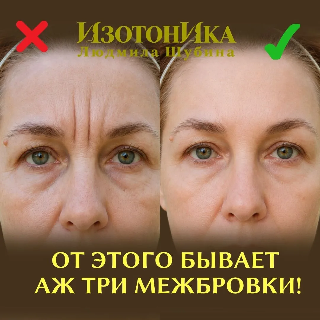 Когда вы хмуритесь — между бровями собираются не одна, а сразу три вертикальных залома....