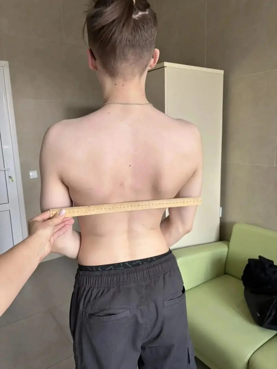 Сколиоз у подростка в Липецке уменьшили без операции  16-летний парень обратился в областную больниц