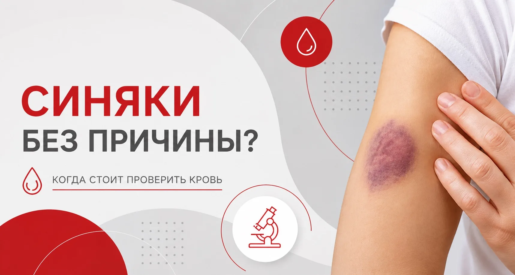 «Откуда у меня опять этот синяк?» 🟣