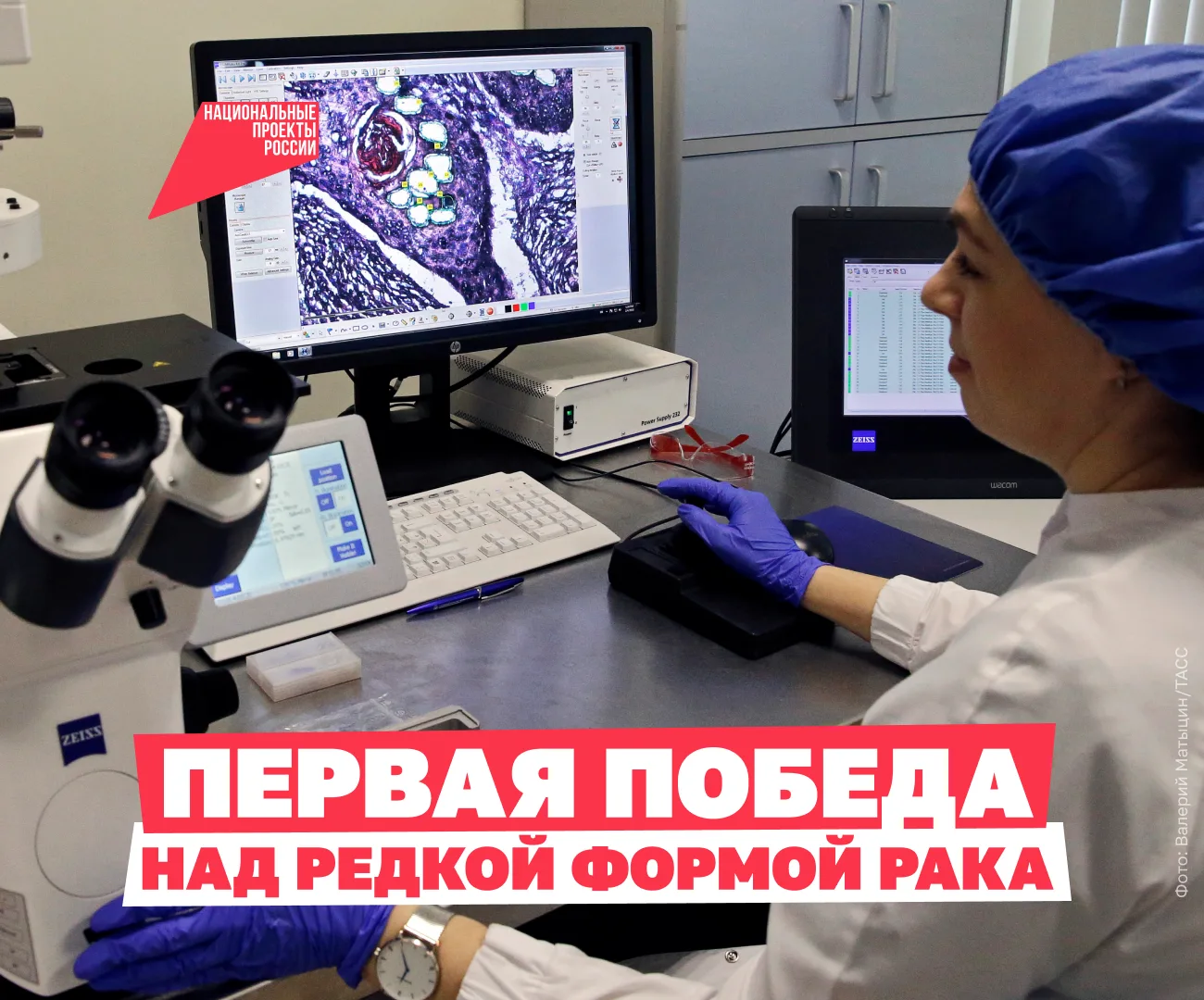 Необычное решение врачей избавило от страшной болезни 👩‍⚕

В тюменской клинике у 67-летней женщины 