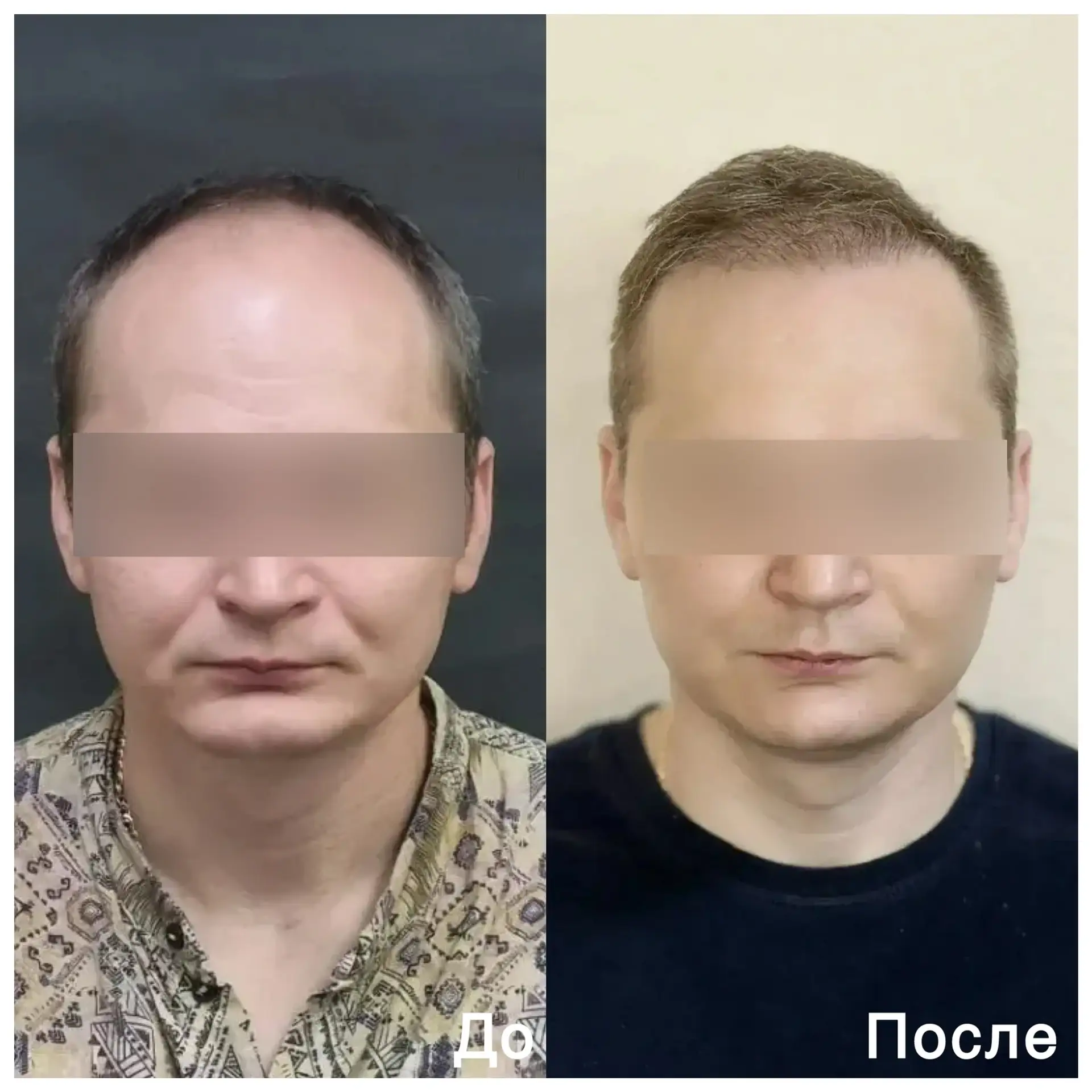 Результат спустя год 🔥