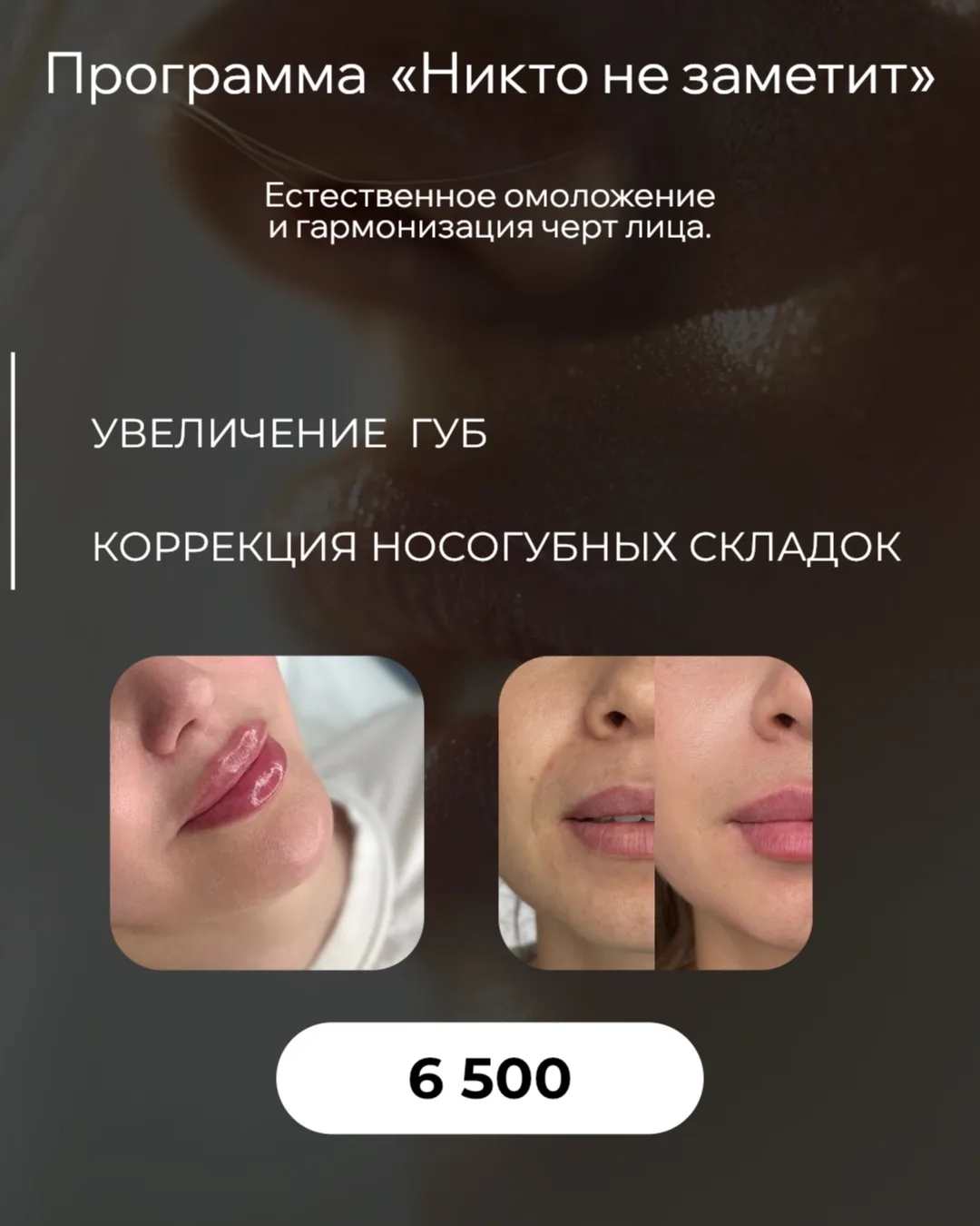 💋 Программа «Никто не заметит»