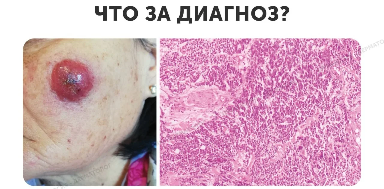 Проверь себя! Что за диагноз?