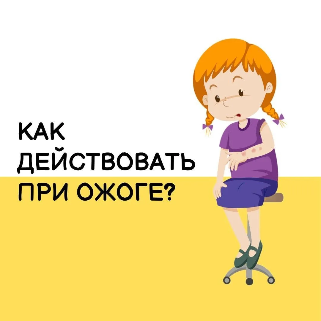 Как правильно действовать при ожоге? Сохраните себе эти карточки с советами на всякий с...