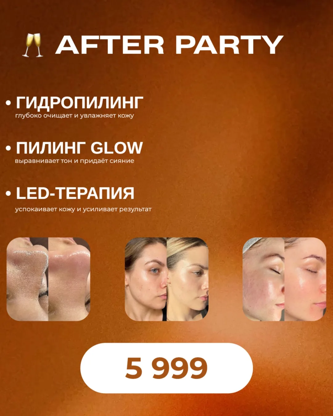 🥂 AFTER PARTY

Когда коже нужен свежий вид и сияние после усталости ✨

• Гидропилинг
• Пилинг Glow
