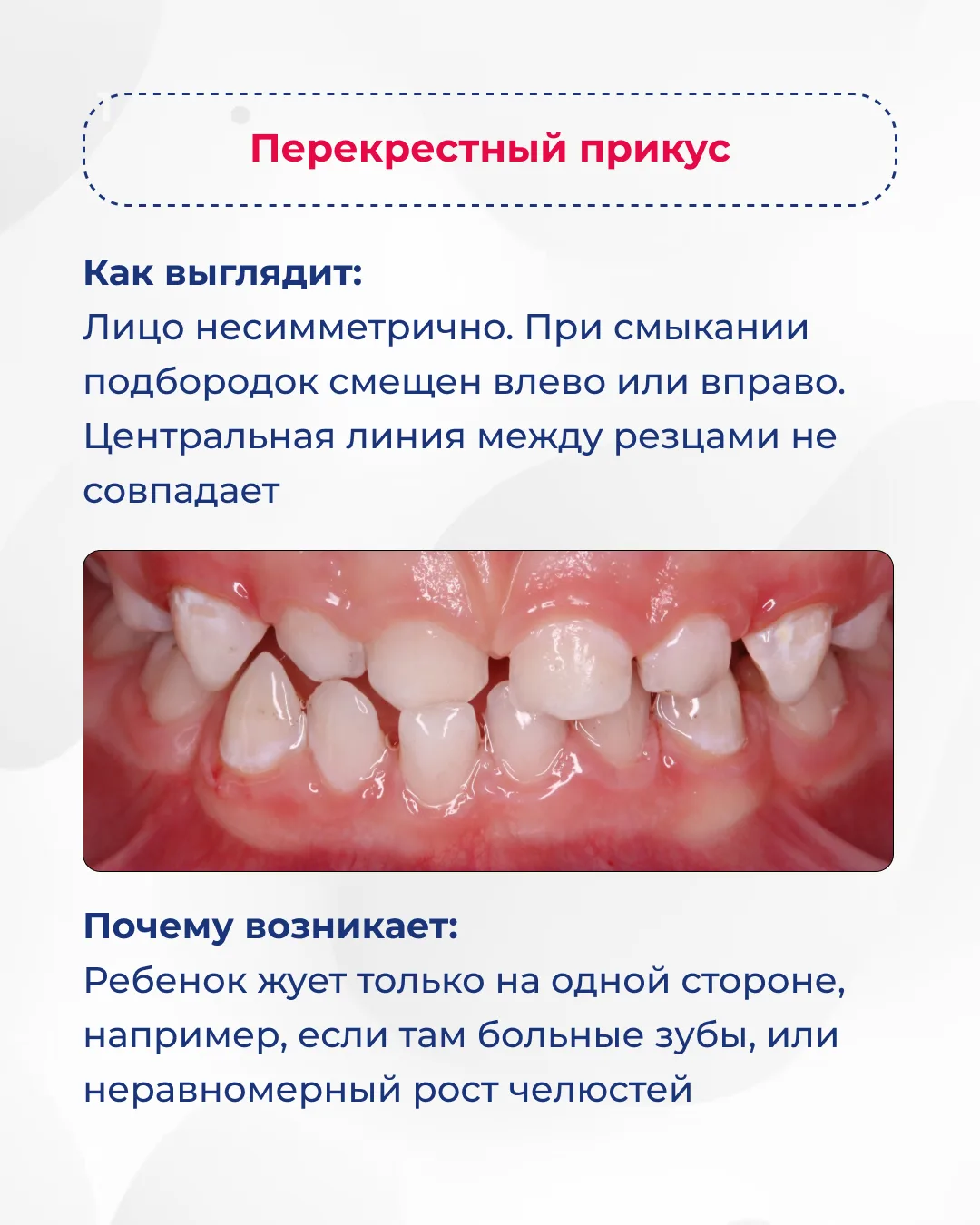 Листайте карусель ➡️  Заметили у своего ребенка один из этих признаков? Запишитесь на консультацию к