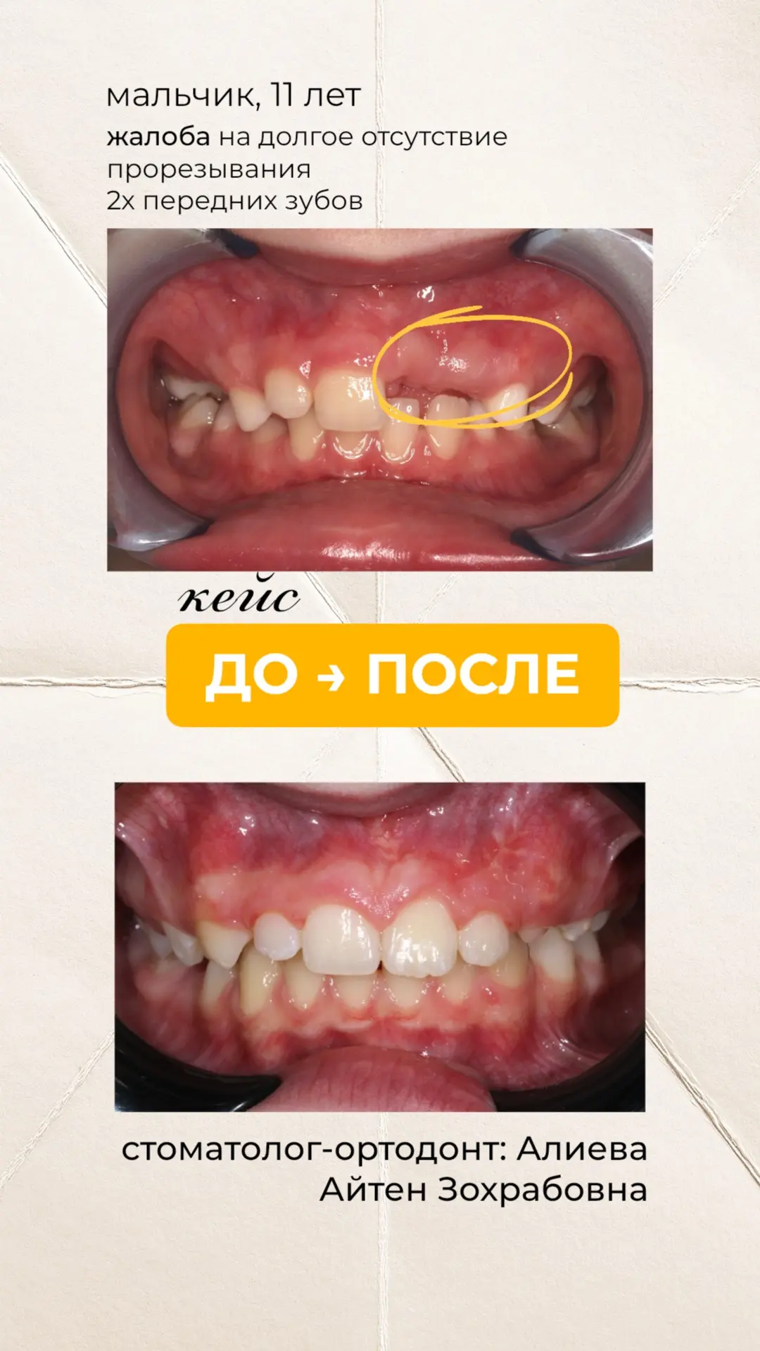 Знакомимся с ещё одним ортодонтом нашей клиники — Алиева Айтен Зохрабовна💛